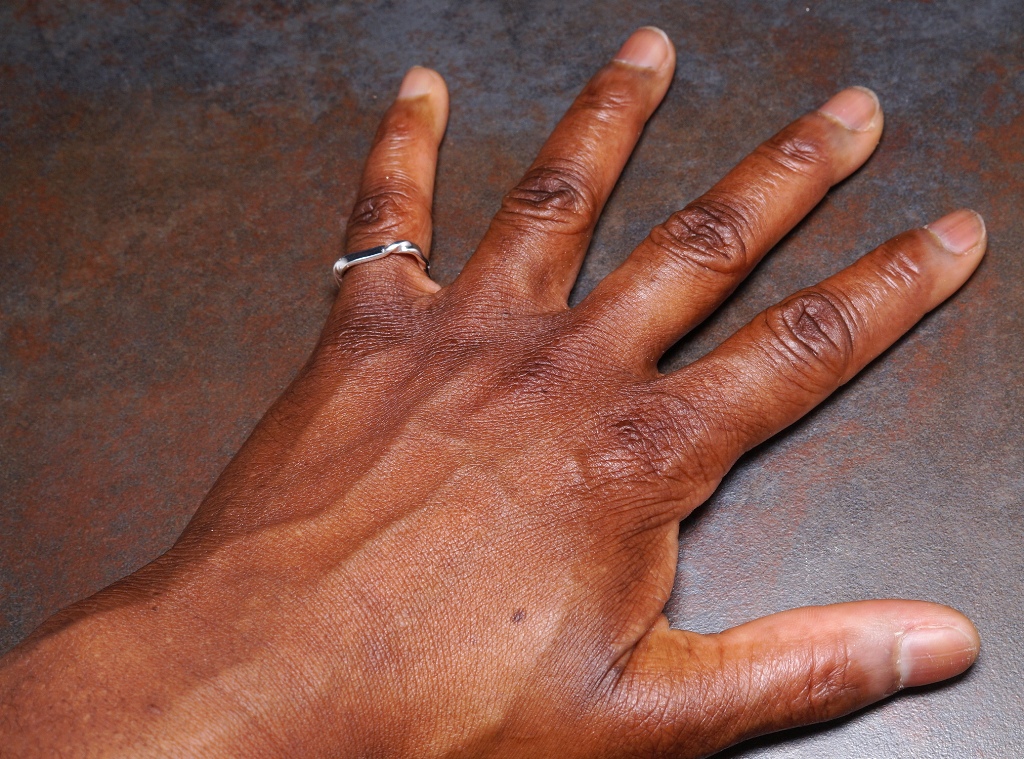 Wearing a ring on your left hand pinky means that you have no interest in getting married