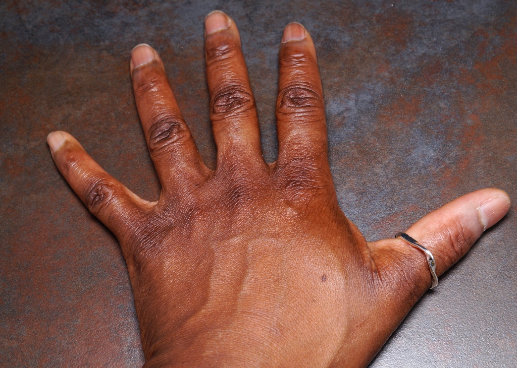 Wearing a ring on your left hand thumb symbolises wealth