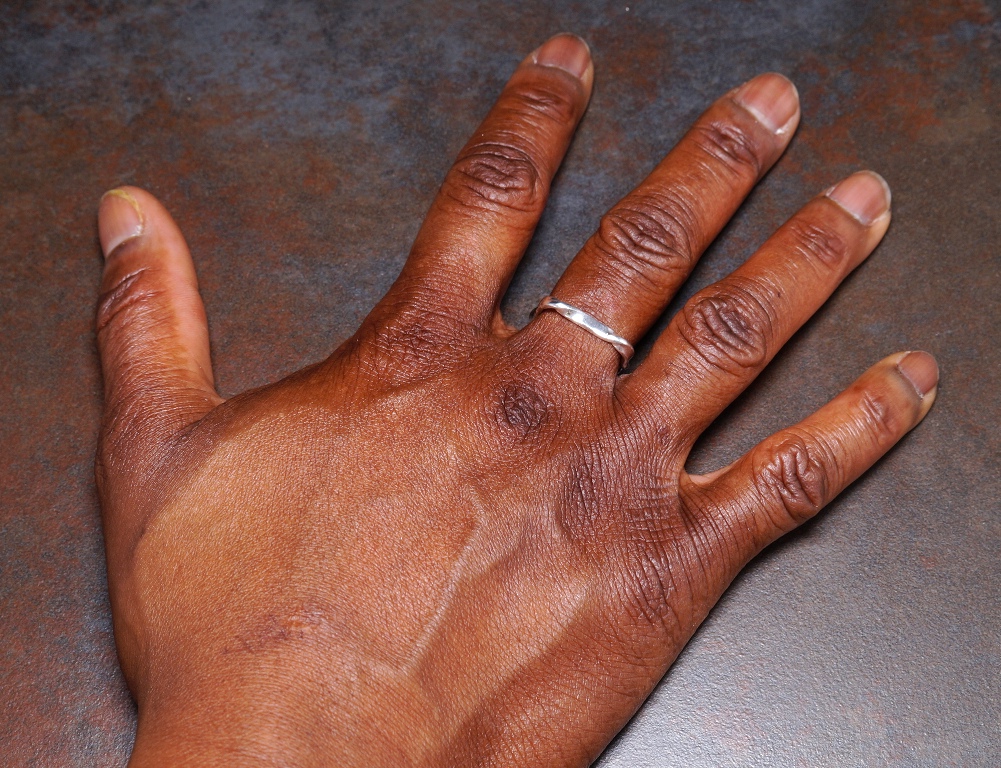 Wearing a ring on your right hand middle means that you are in a relationship