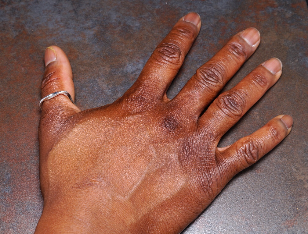 Wearing a ring on your right hand thumb symbolises wealth
